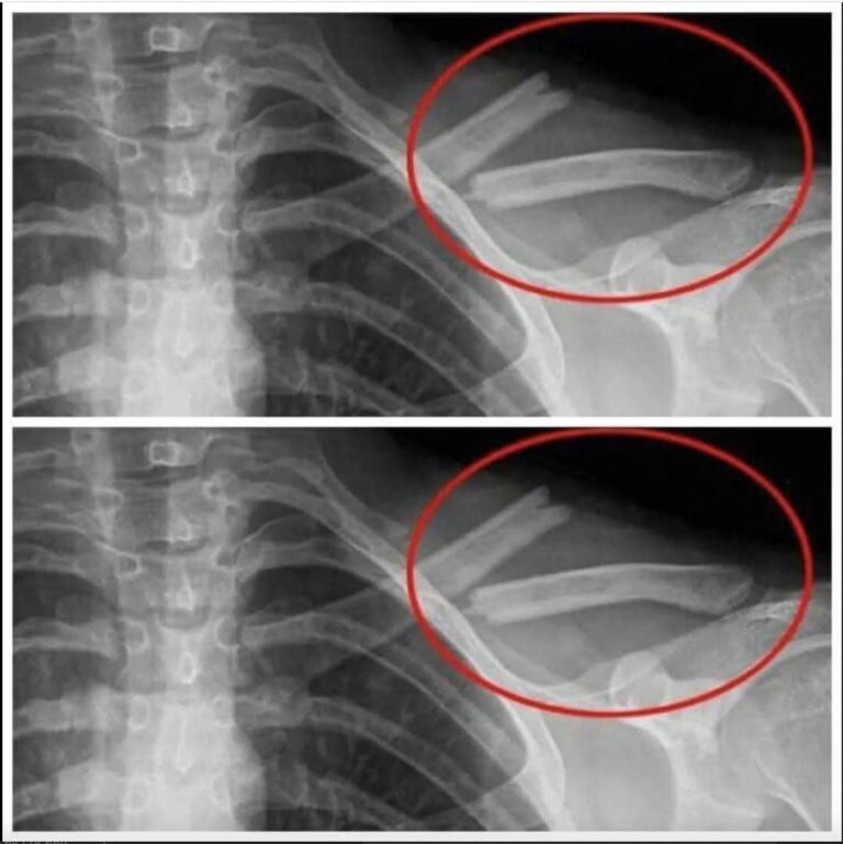 8 things that happen to your body when you stop drinking diet soda