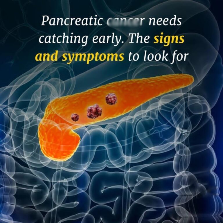 Pancreatic canc3r symptoms you should know, and how the disease develops