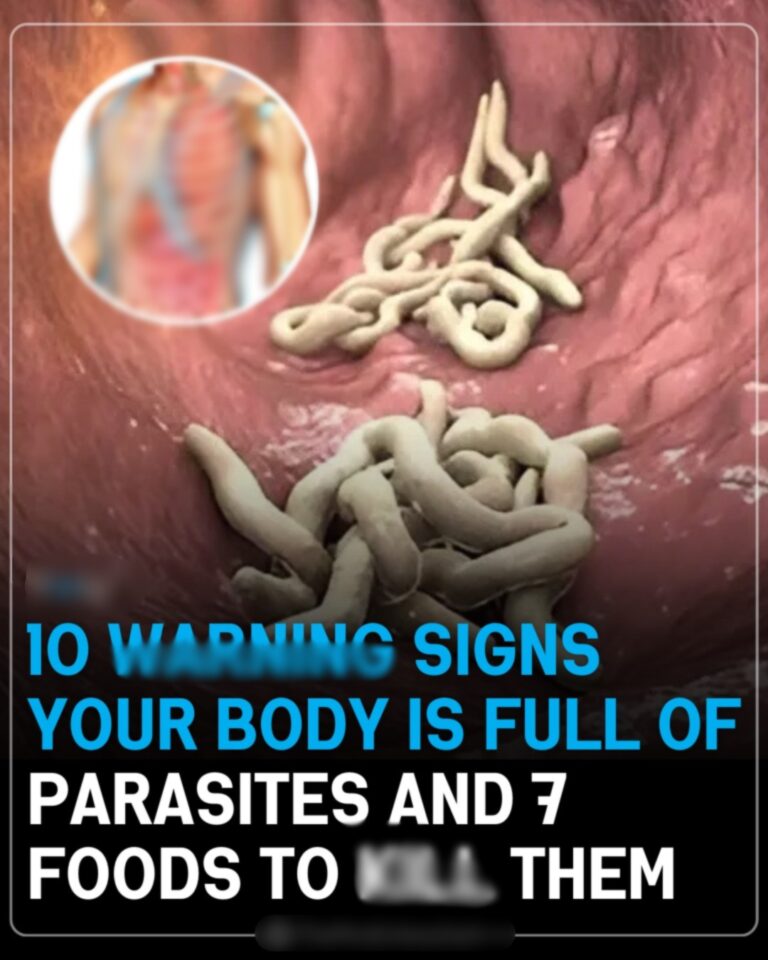 10 War:ning Signs Your Body Is Full Of Parasites And 7 Foods That Can Help Remove Them