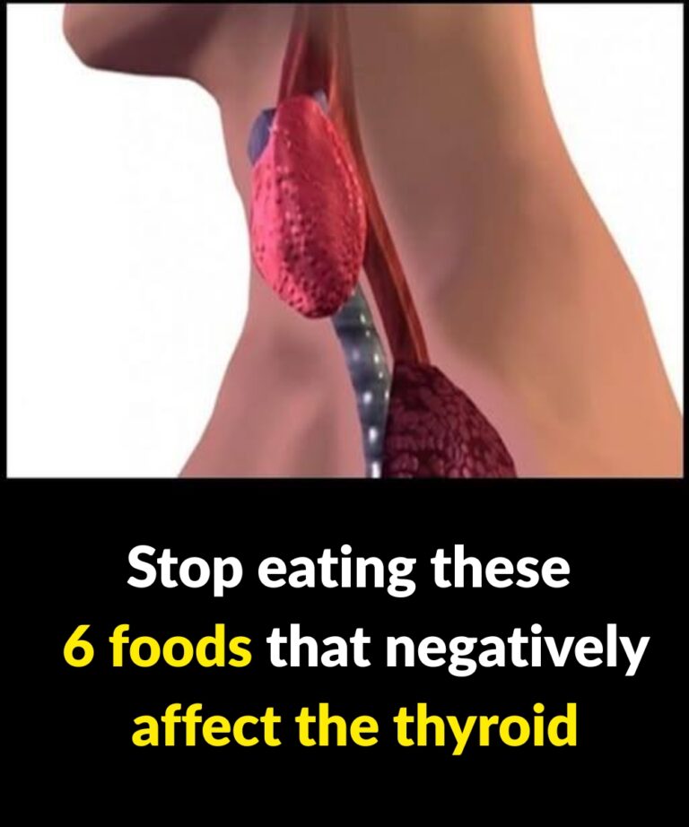 6 types of foods that negatively affect your thyroid