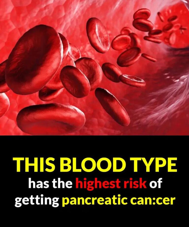 Doctors reveal the one bl00d type which has the highest risk of getting pancreatic canc3r